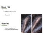Fixderma Kairfoll Anti Dandruff Shampoo for Oily Sensitive Scalp Prone to Dandruff & Folliculitis | Anti Dandruff Shampoo for Women & Men | Salicylic Acid for Hair Fall | Sulphate Free Shampoo - 100ml - Image 8