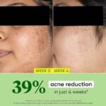 Dot & Key CICA Calming Skin Renewing Night Gel | For Oily, Acne Prone And Sensitive Skin | Night Cream with Niacinamide, Green Tea & Hyaluronic | Fades Blemishes & Dark Spots | 60ml - Image 3