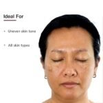 Fixderma Tranexamic Acid Serum, Pigment Correcting Serum | Face Serum for Melasma, Hyperpigmentation & Acne Spots | Acne Serum | Face Serum for Men & Women - 15g - Image 5