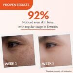 Fixderma Tranexamic Acid + 2% Kojic Acid + 1% Arbutin SKARFIX -TX Face Cream | Pigmentation Removal Cream | Kojic Acid Cream | Uneven Skin Tone - 15 gm - Image 5