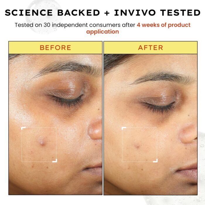 Hyphen 10% Vitamin C, 1% Vitamin E & Ferulic Acid Serum| Clinically Tested to Brighten, Treat Dark Spots & Pigmentation | 12Hr Slow Release Formula| Non-Irritating, Suitable for Sensitive Skin – 20ml - Image 8