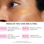 Hyphen Advanced De-Pigmentation Serum For Hyperpigmentation, Melasma, Dark Spots & Scars With 2% Kojic Acid | Visibly Brightens & Even Tones Skin | Serum For Women & Men - 30ml - Image 7