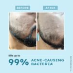 Hyphen Clarifying Acne Face Wash for Women and Men | Cleanser For Acne Prone Skin with Salicylic Acid 2%, Zinc PCA, Witch Hazel 10% | Oil Control Pore Cleasning | Antibacterial & Non-Drying - 100ml - Image 3