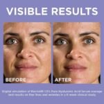 L'Oreal Paris 1.5% Pure Hyaluronic Acid Serum for Face from Revitalift Derm Intensives for Dewy Looking Skin, Anti Aging Serum, 15ml (From Philippines) - Image 3