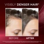 L'Oréal Paris Fall Resist Anti Hair Fall Serum with 1.5% Aminexil, Caffeine & Arginine for lesser visible scalp & hair fall, 102ml - Image 6