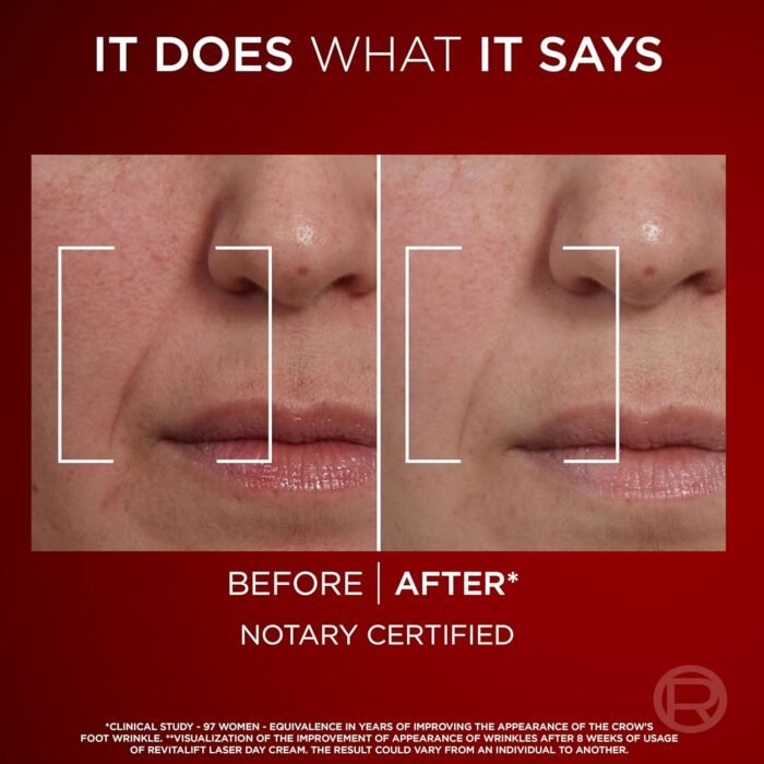 L'Oréal Paris Revitalift Laser X3, Anti-Ageing Day Cream SPF 15, Firming And Brightening, With Pro-Retinol, Hyaluronic Acid And Vitamin Cg, 50ml - Image 5