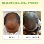 Avimee Herbal Keshpallav Hair Oil for Hair Growth | For Both Men & Women | Helps to reduce Hair Fall | With Rosemary, Castor, Amla, Coconut and Bhringraj Oil | Mineral Oil Free | 100 ml - Image 5