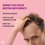 Carbamide Forte High Potency Biotin Tablets 10000mcg For Hair Growth 60 Veg Tablets - Image 5