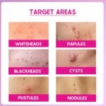 Cos-IQ 15% AHA + 2% BHA + 5% PHA Peeling Solution Serum for Glowing Skin, Smooth Texture & Pore Cleansing | 22% AHA BHA PHA Peel For Regular Exfoliating Peel | 30ml - Image 5