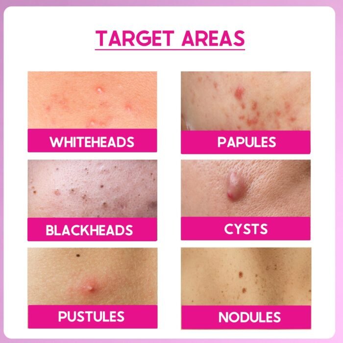 Cos-IQ 15% AHA + 2% BHA + 5% PHA Peeling Solution Serum for Glowing Skin, Smooth Texture & Pore Cleansing | 22% AHA BHA PHA Peel For Regular Exfoliating Peel | 30ml - Image 5