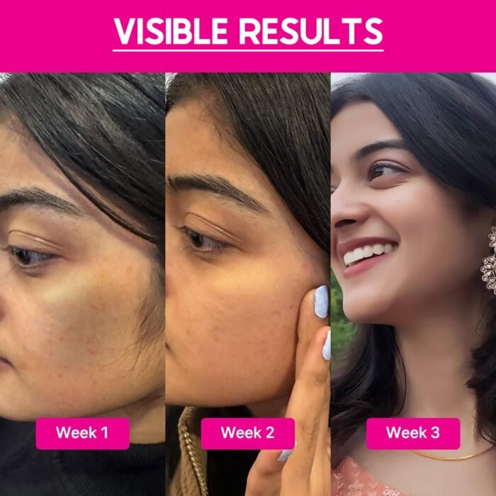 Cos-IQ 15% AHA + 2% BHA + 5% PHA Peeling Solution Serum for Glowing Skin, Smooth Texture & Pore Cleansing | 22% AHA BHA PHA Peel For Regular Exfoliating Peel | 30ml - Image 7