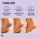 Carbamide Forte 20% Urea Foot Cream Roll-On 50ml | Foot roll on for cracked heels | With Lactic Acid, Shea Butter & Olive Oil | Helps Repair, Exfoliate & Moisturise Cracked Heels - Image 8