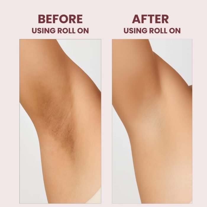 Carbamide Forte Underarm Roll On with 6% AHA BHA Mandelic, Salicylic, and Lactic Acid | Prevents Body Odour, Fades Pigmentation | Underarm Roll On for Women & Men - 50ml - Image 4